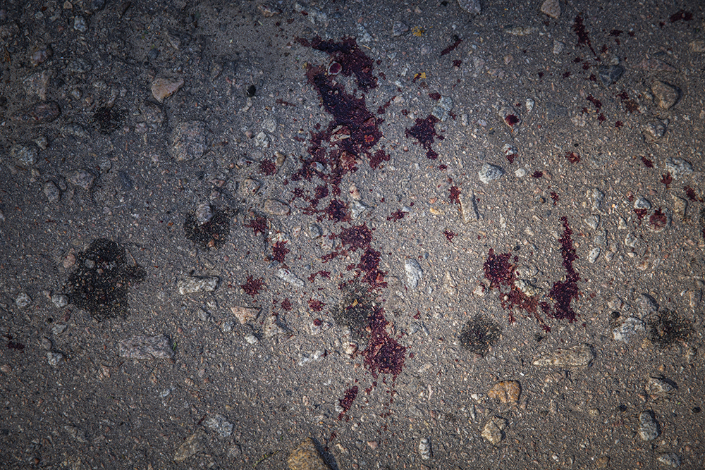 Blood Stains After Russian Attack on Residential Neighborhood